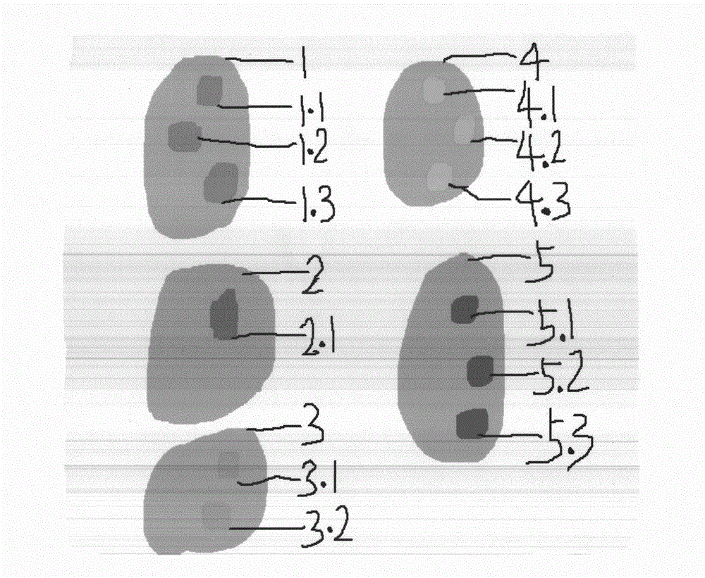 EBV transfected chimera quality-control cell for birth defect antenatal diagnosis and preparation method thereof