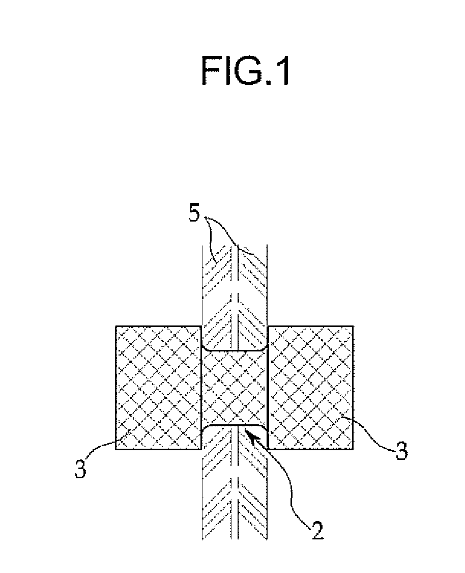 Stent for connecting adjacent tissues of organs