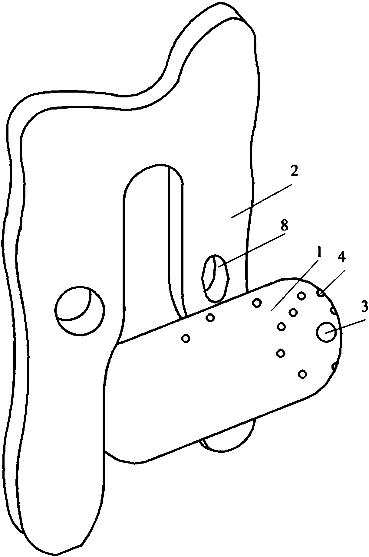 Implantation guide device for cervical cancer brachytherapy minimally invasive surgery