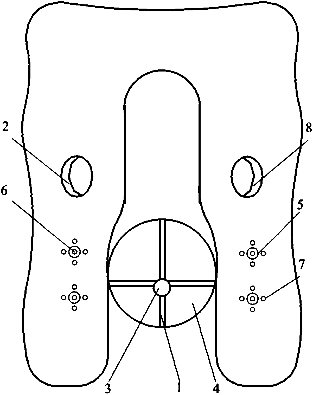 Implantation guide device for cervical cancer brachytherapy minimally invasive surgery