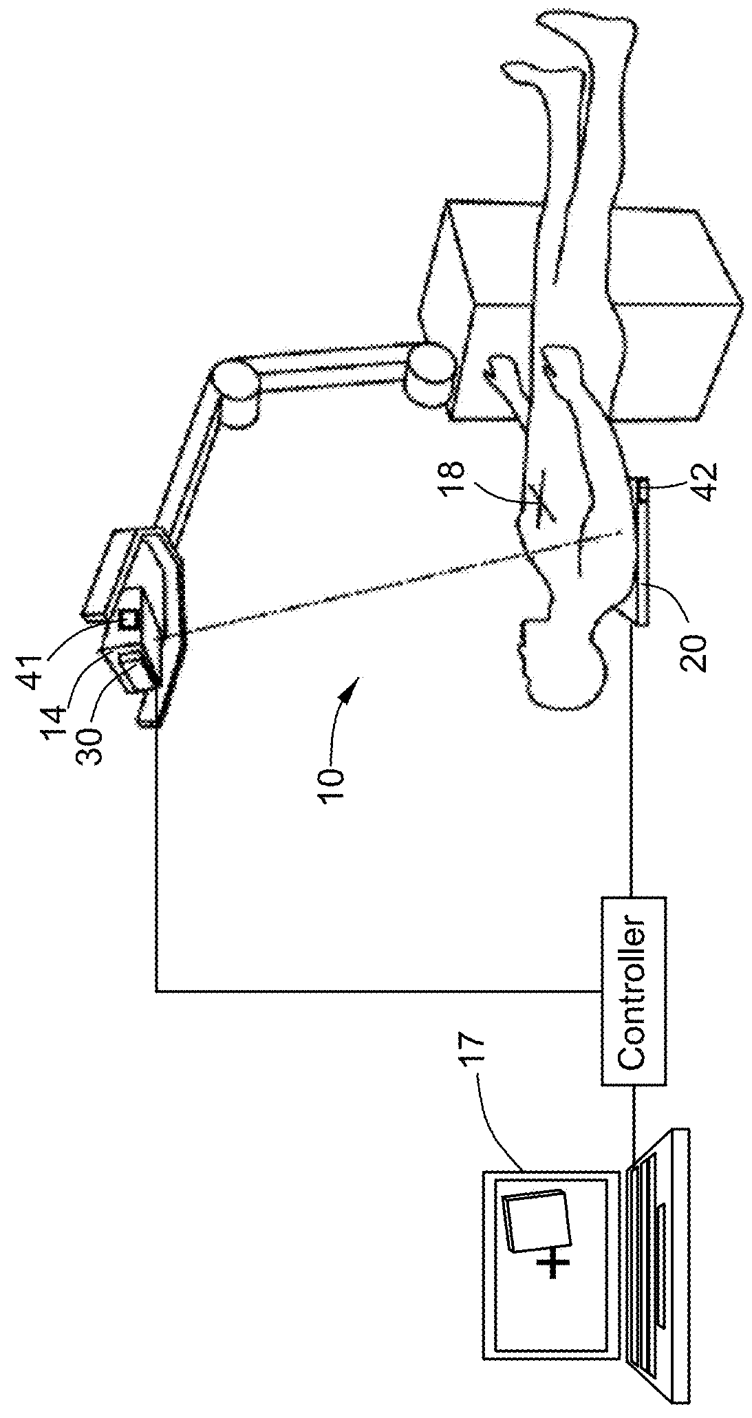 Mobile radiography system and method for alining mobile radiography system