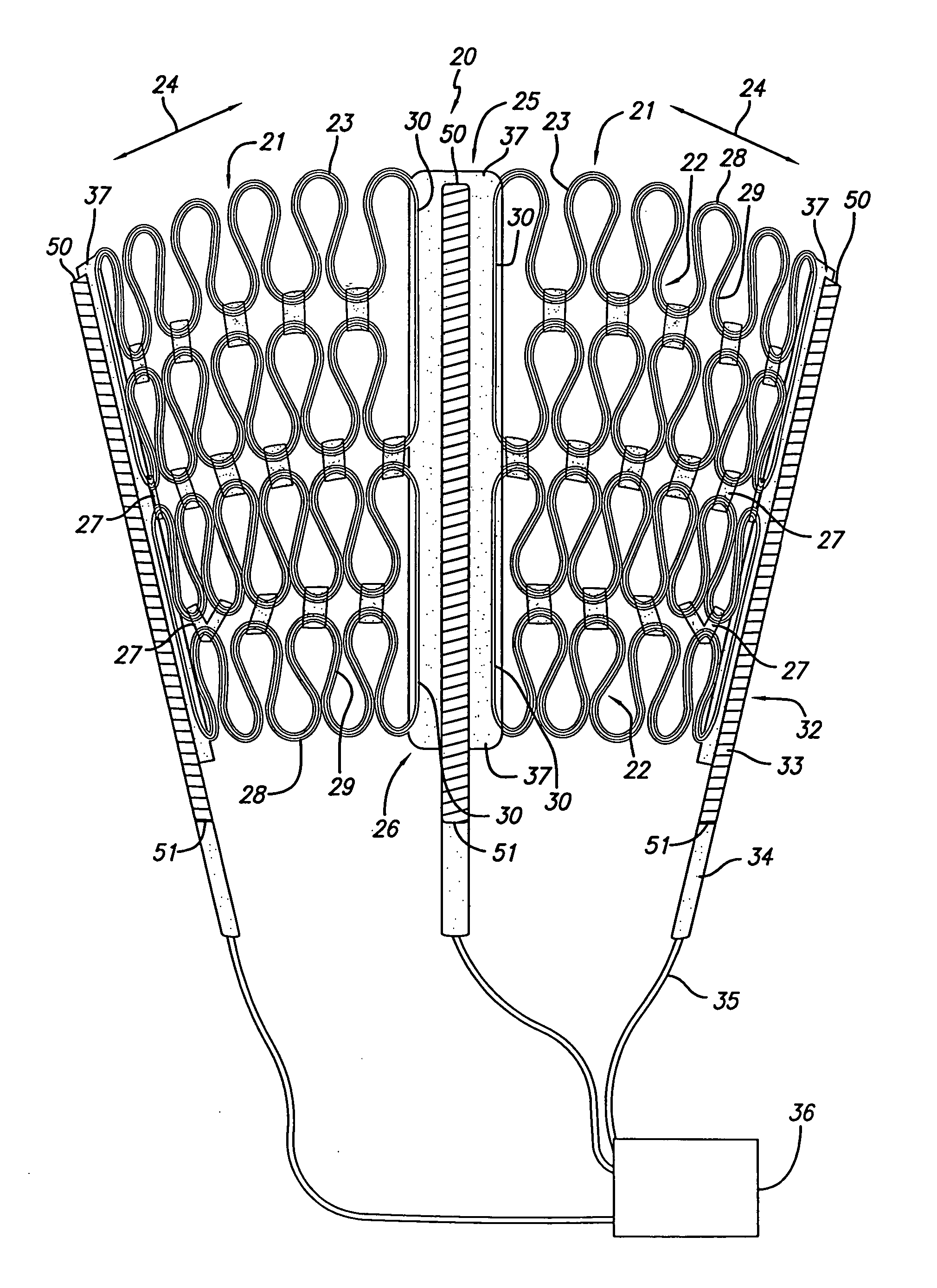 Cardiac harness for treating congestive heart failure and for defibrillating and/or pacing/sensing