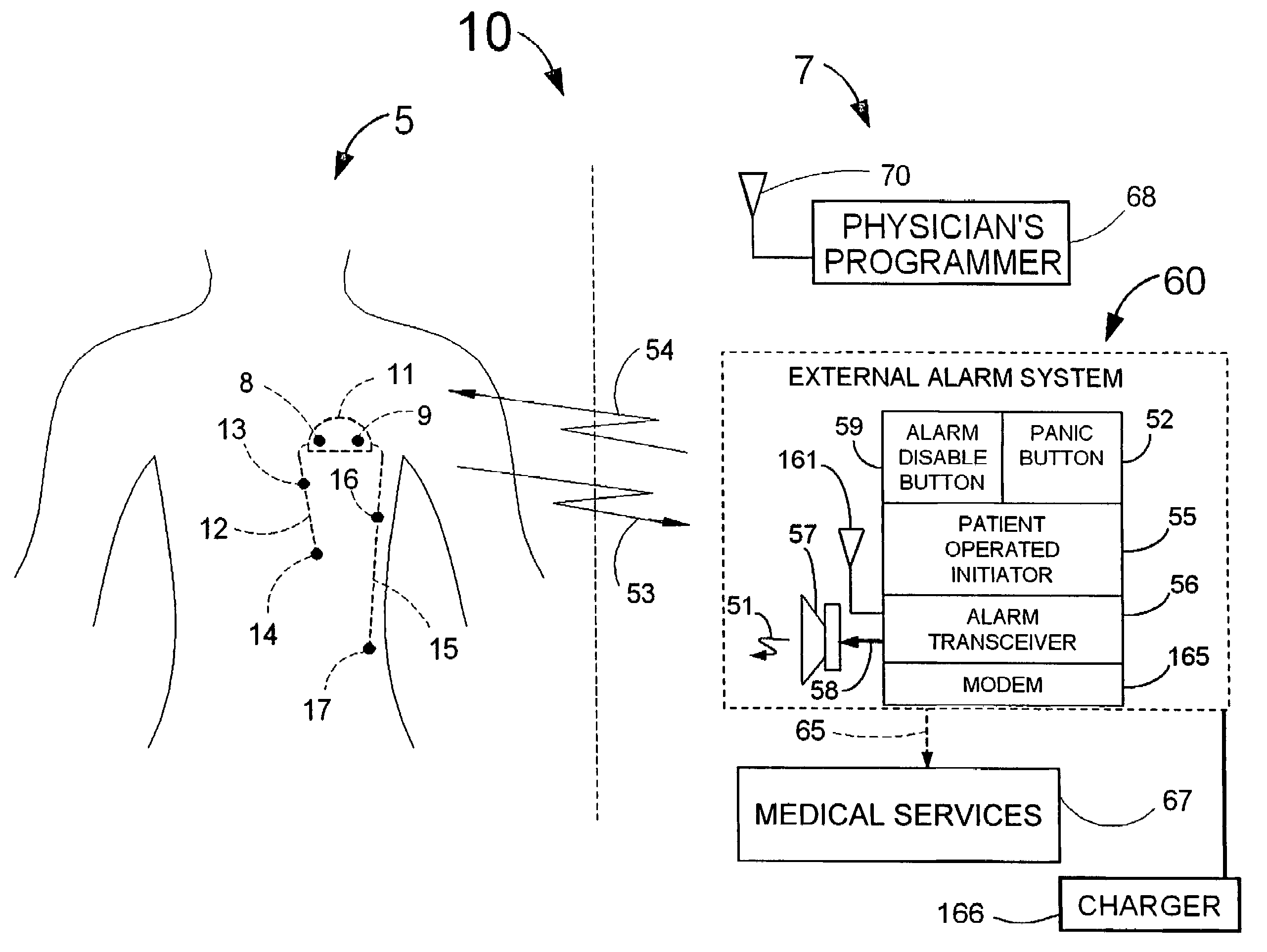 Implantable system for monitoring the condition of the heart