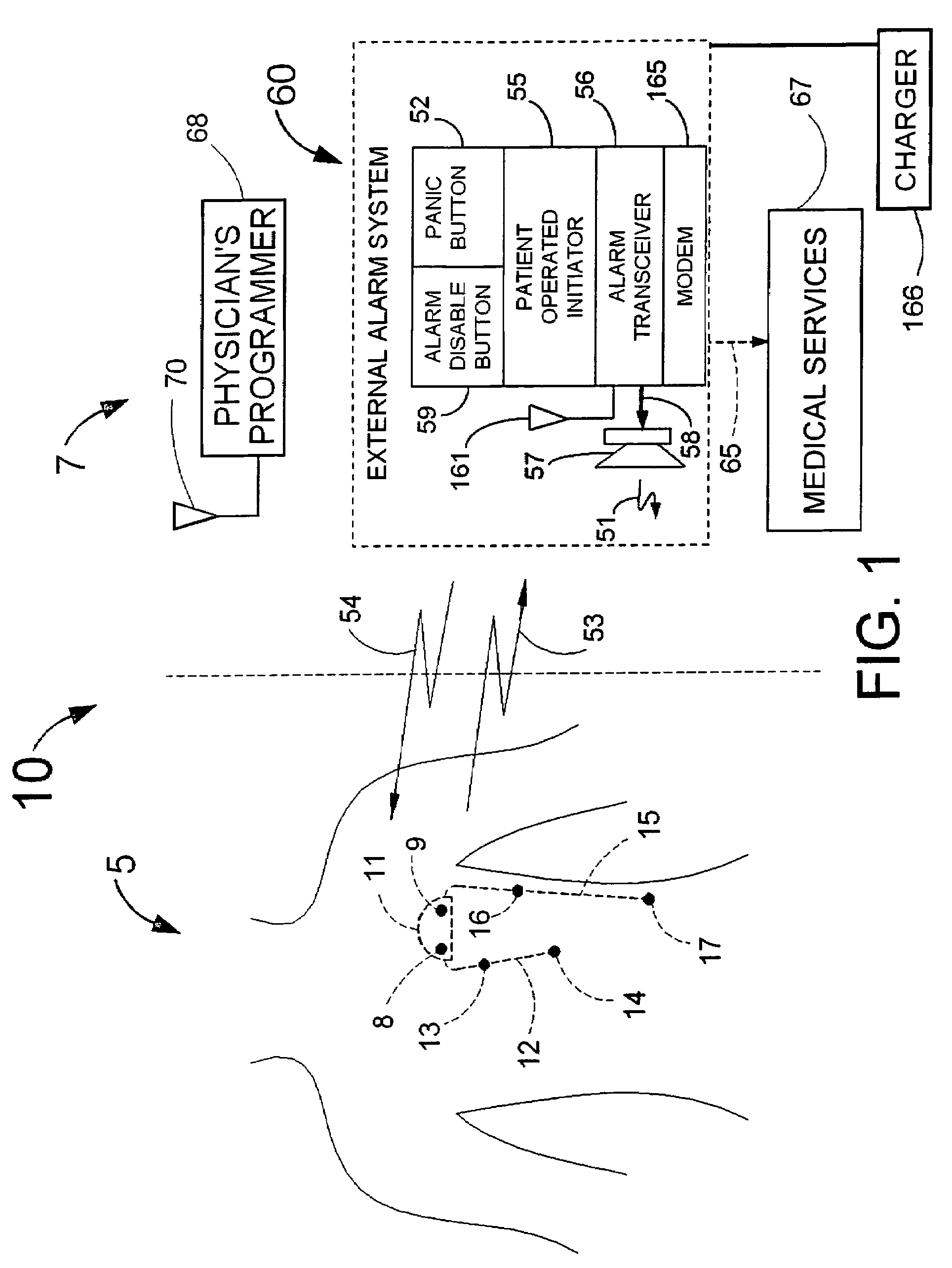 Implantable system for monitoring the condition of the heart