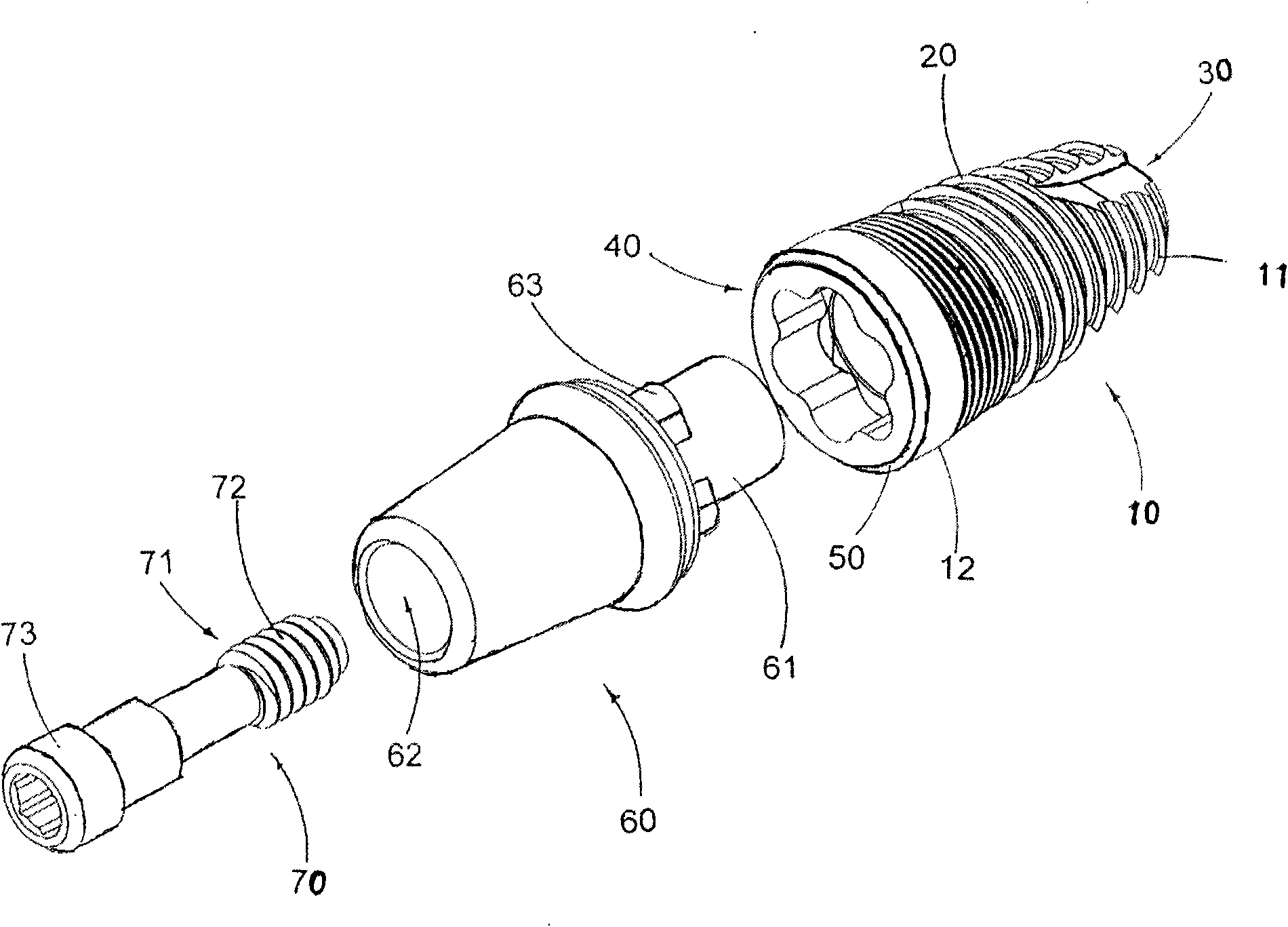 Dental implant