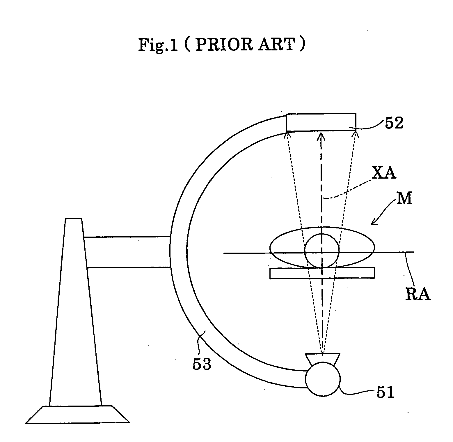 Radiographic apparatus