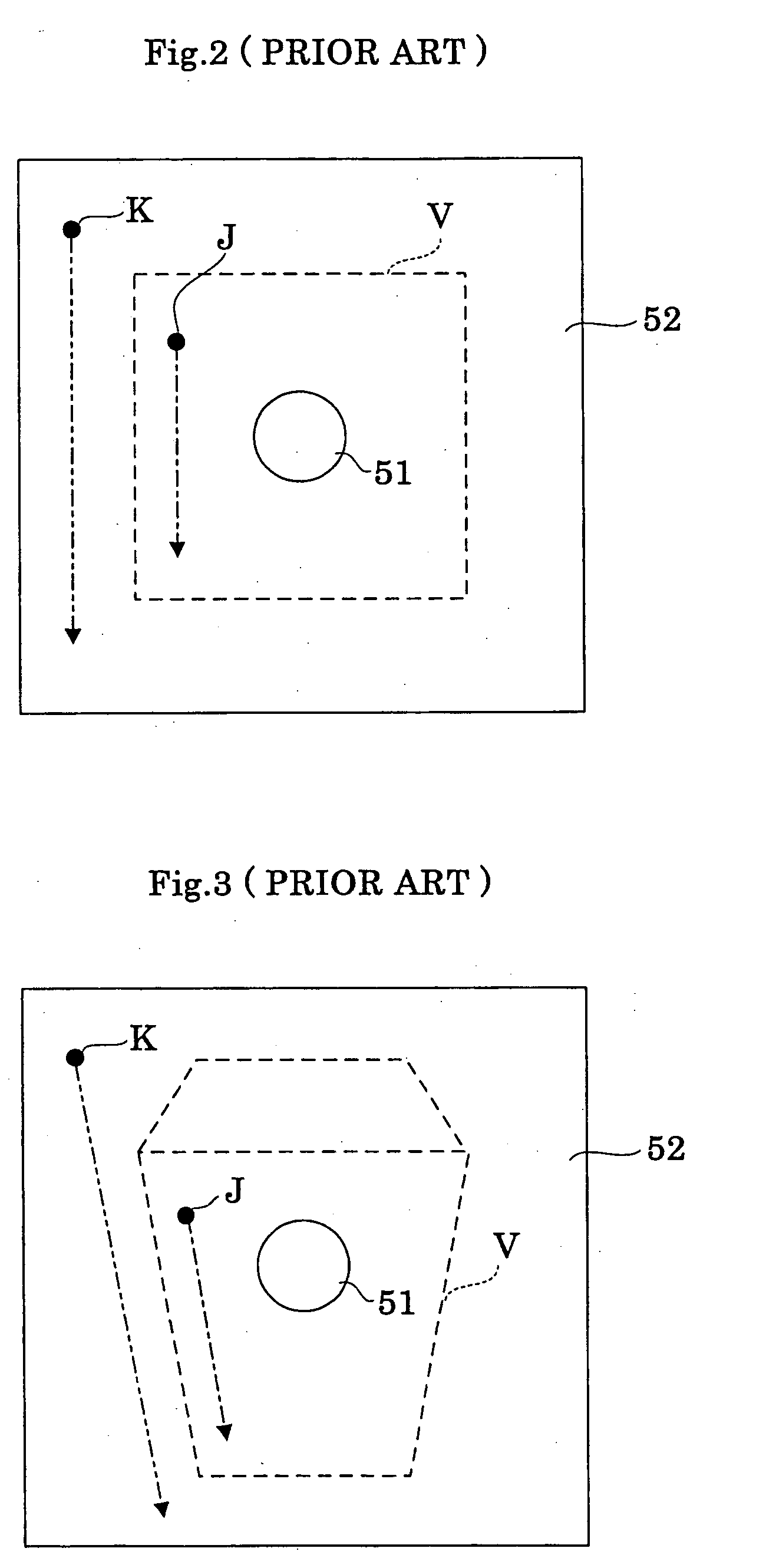 Radiographic apparatus