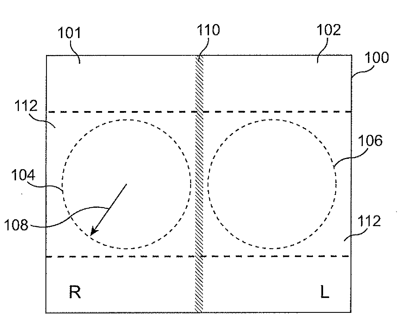 Stereoscopic endoscope