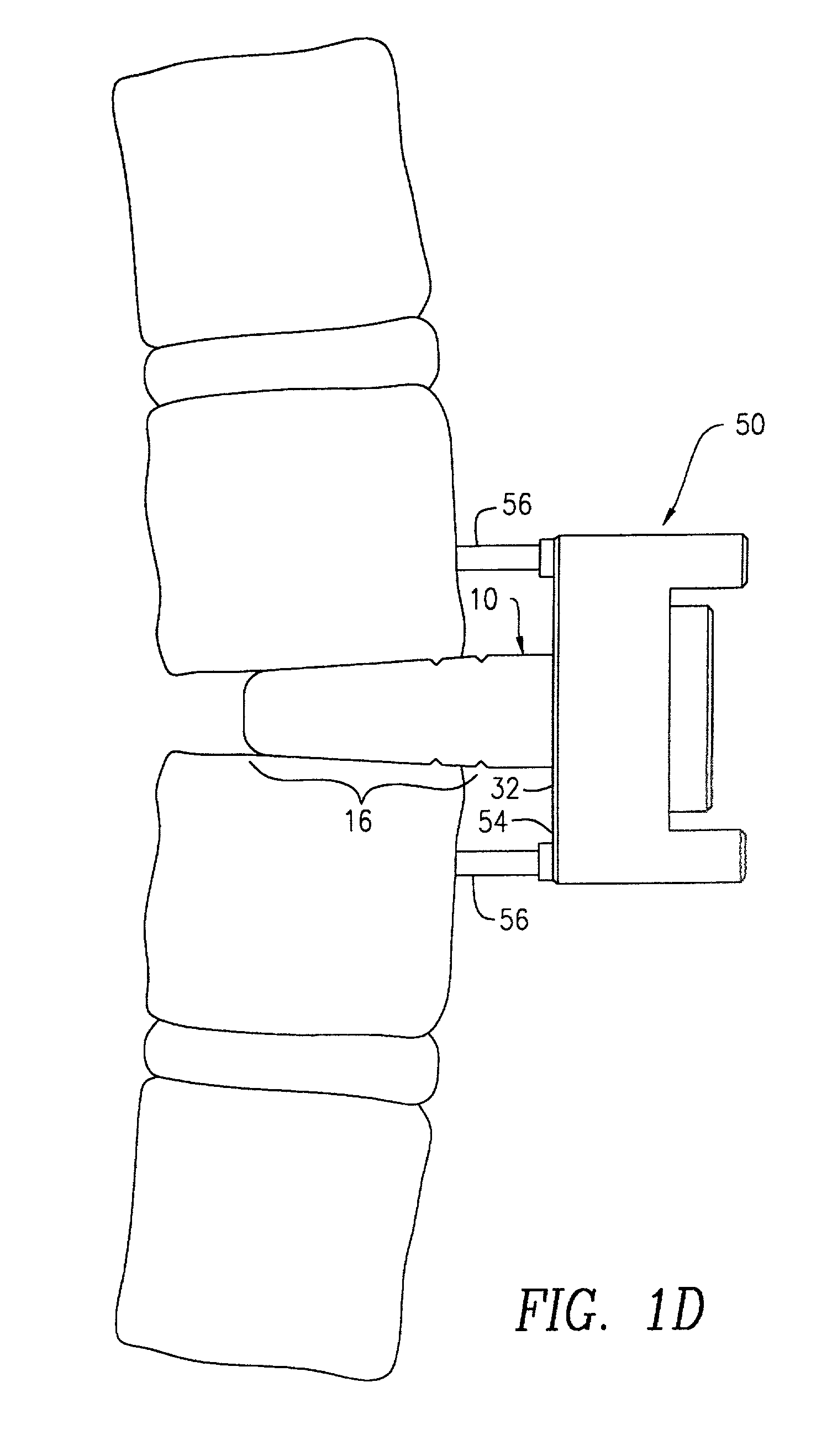 Instrument system for preparing a disc space between adjacent vertebral bodies to receive a repair device
