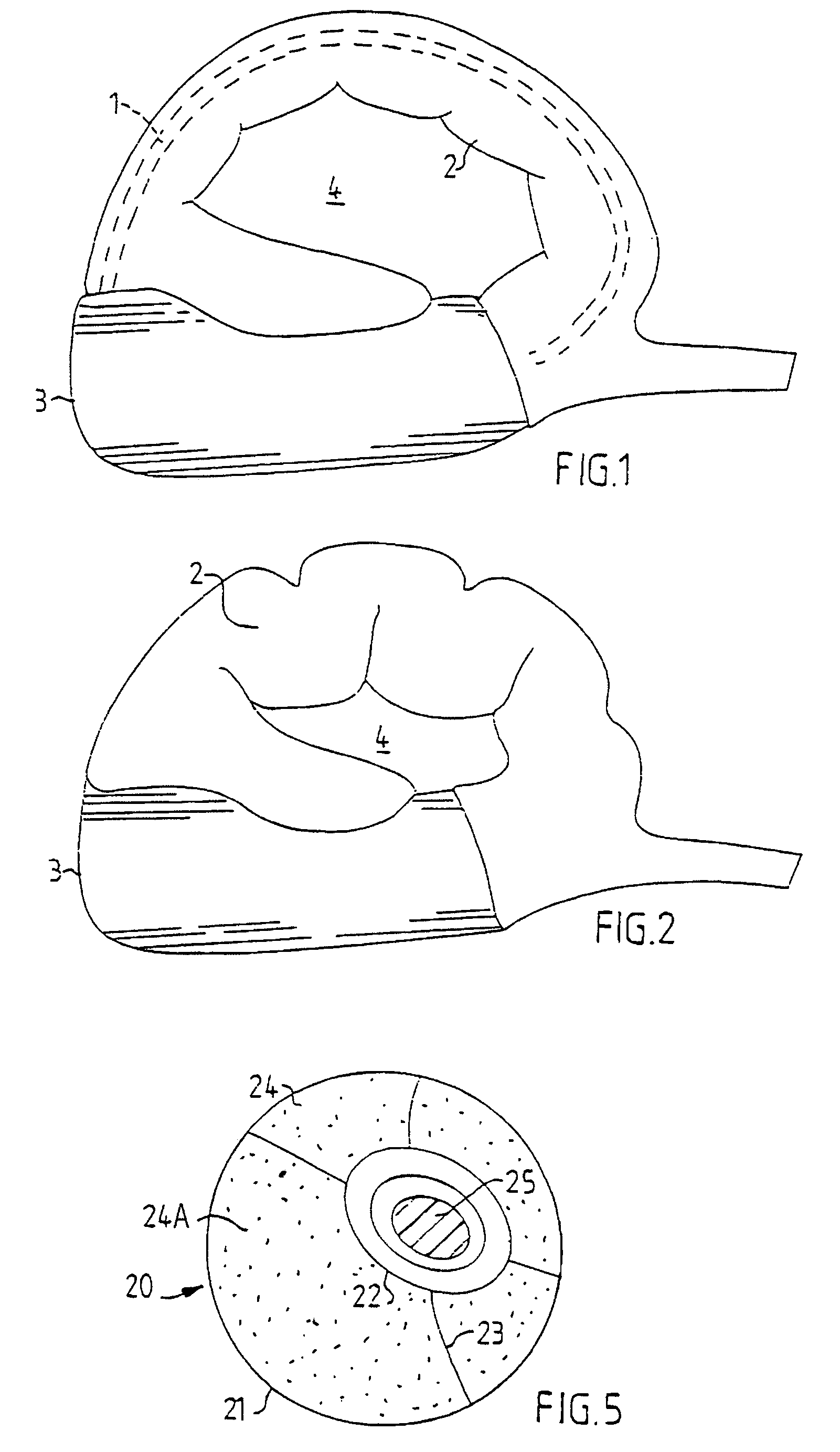 Careful impotence treatment apparatus