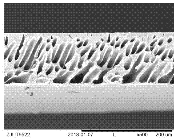 Sulphobetaine metacrylic acid ester grafted polysulfone copolymer as well as preparation method and application of polysulfone copolymer