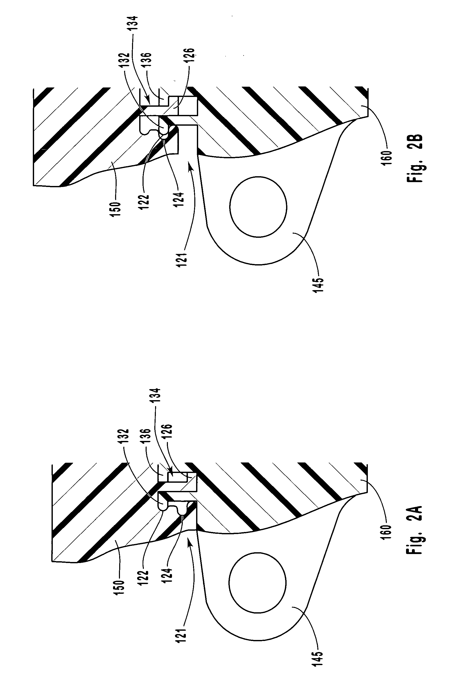 Rotatable suture ring