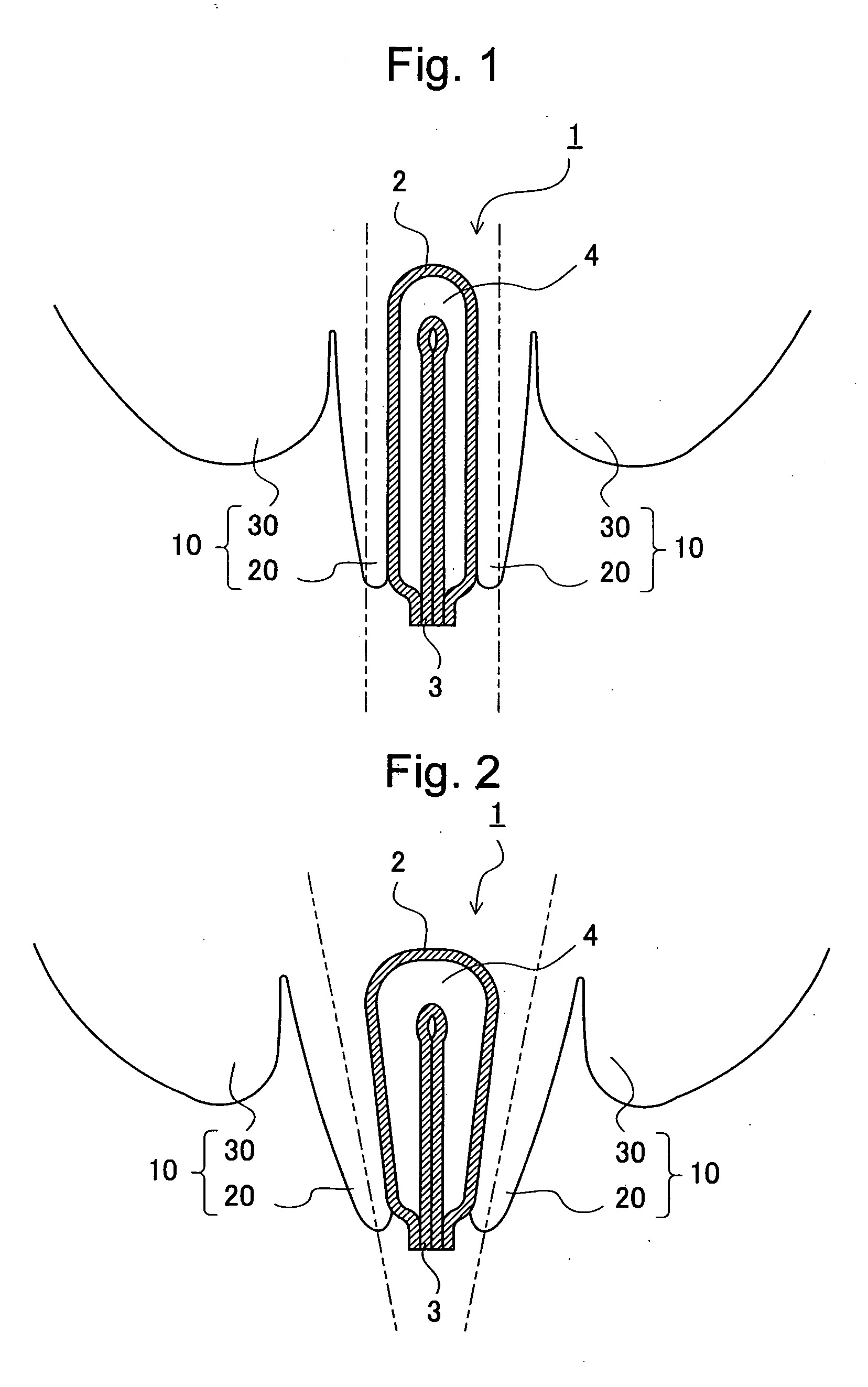 Interlabial pad