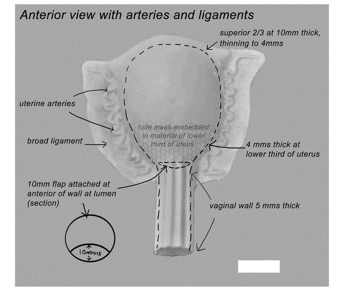 Simulator for training medical personnel to perform uterine procedures