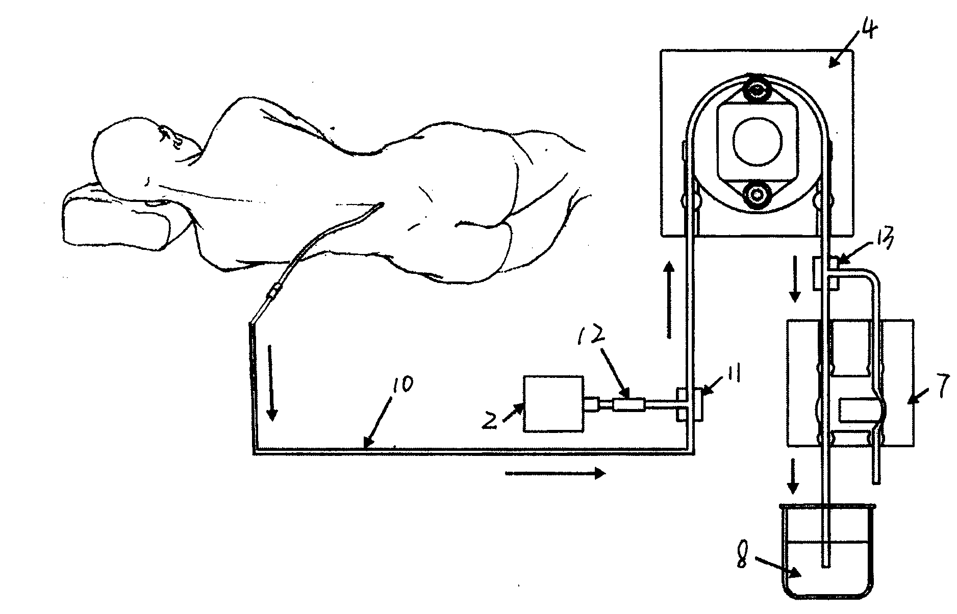 Cerebrospinal fluid external displacement instrument