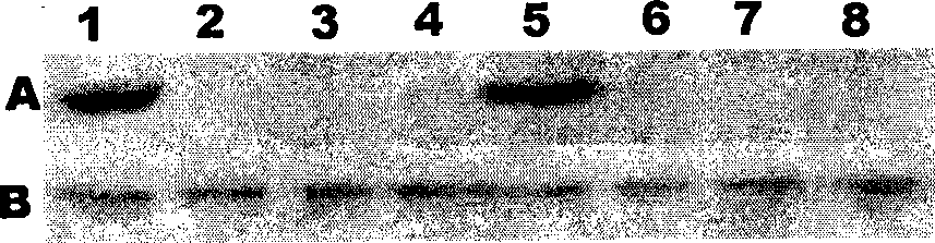 Anti-tumor DNA vaccine and preparation method thereof