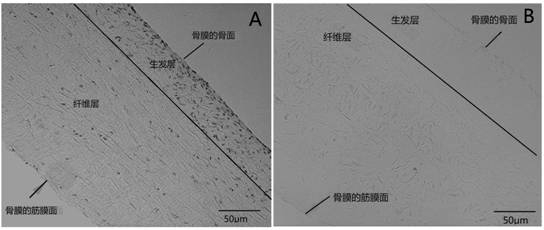 Oral guided bone regeneration membrane prepared from sheep periosteum acellular matrix and preparation method thereof