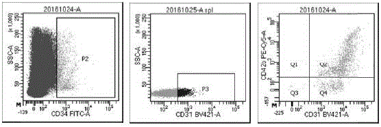 Method for preparing autologous beautifying micro-needle preparation and application thereof