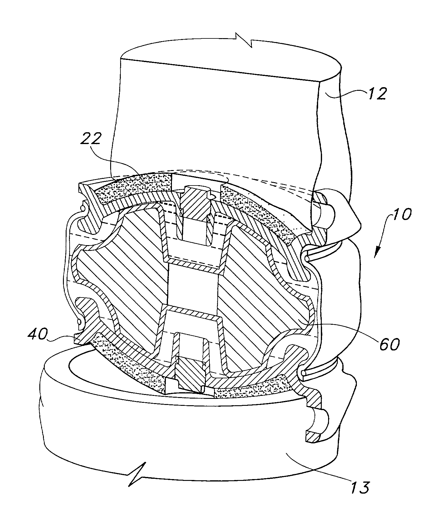 Implantable joint prosthesis