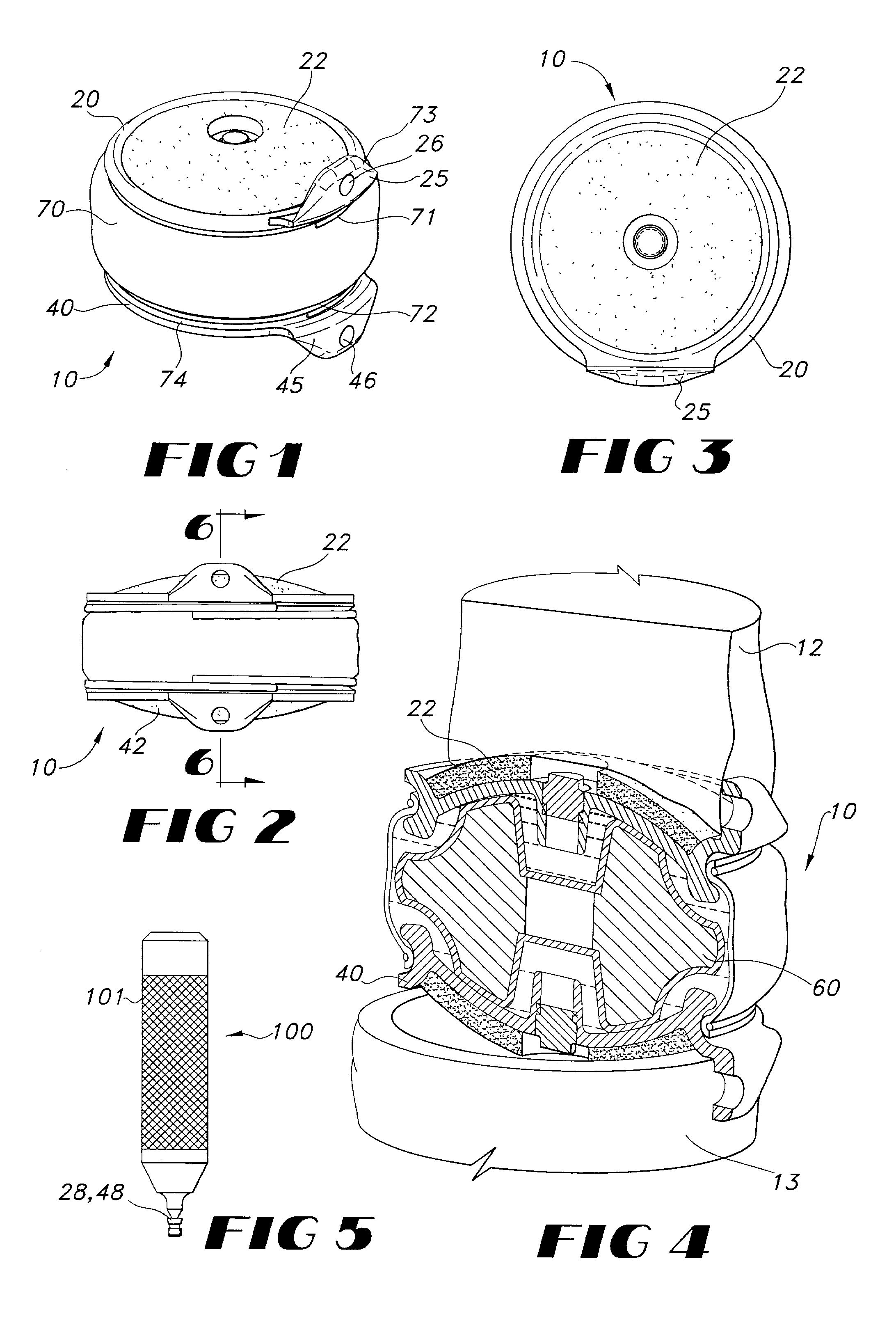 Implantable joint prosthesis