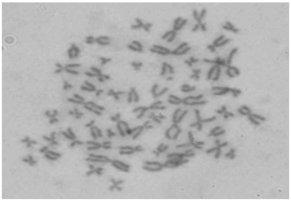 A kind of human thymoma cell line and its application