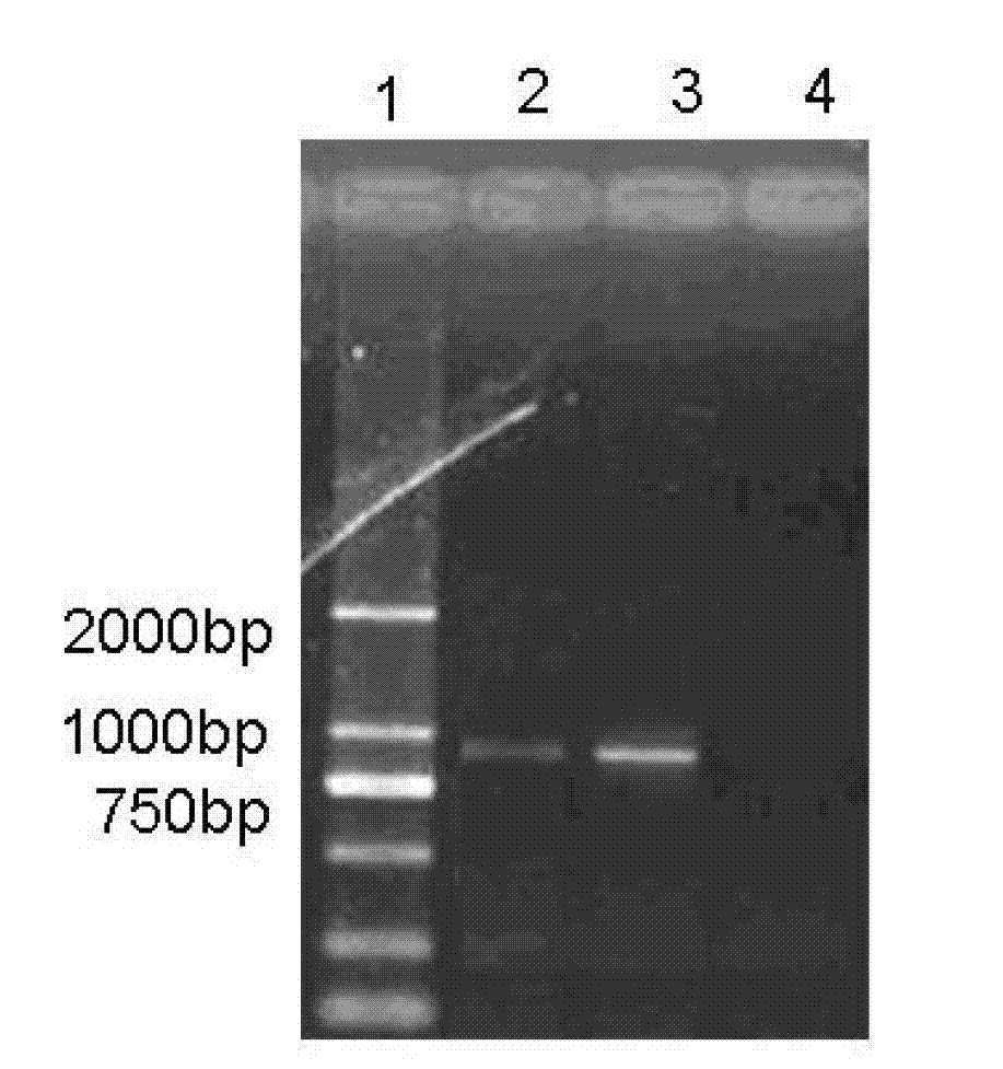 Vaccine composition for preventing and treating porcine circovirus type 2, haemophilus parasuis and mycoplasma hyopneumoniae infection and preparation method thereof