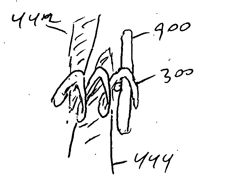 Devices and methods for closing a patent foramen ovale using a countertraction element