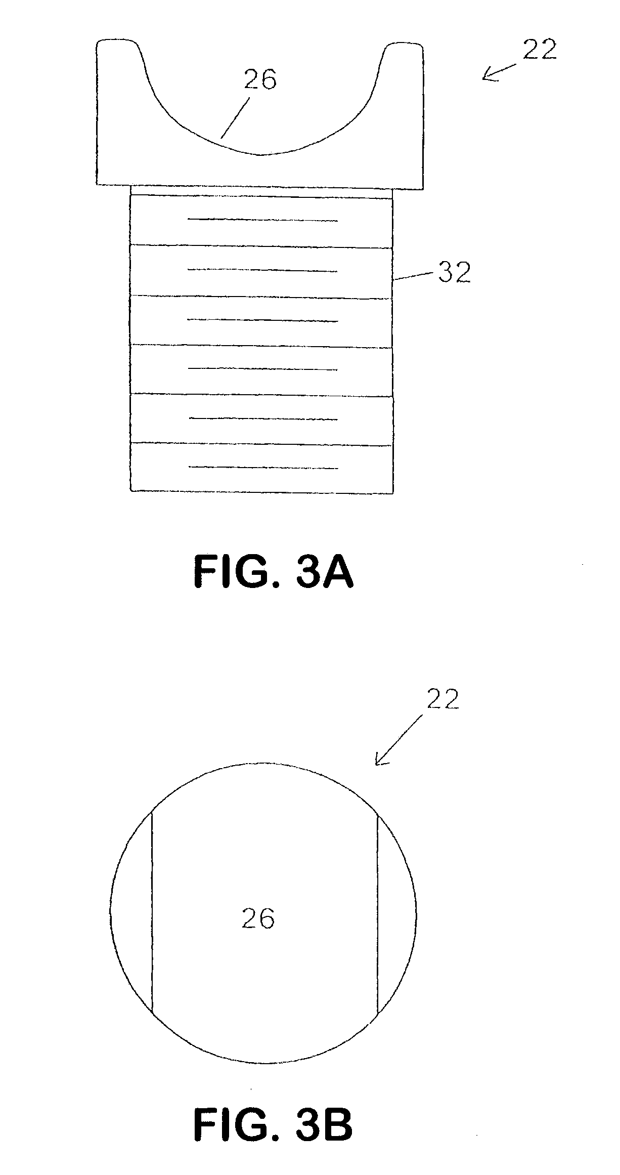 Spine distraction implant