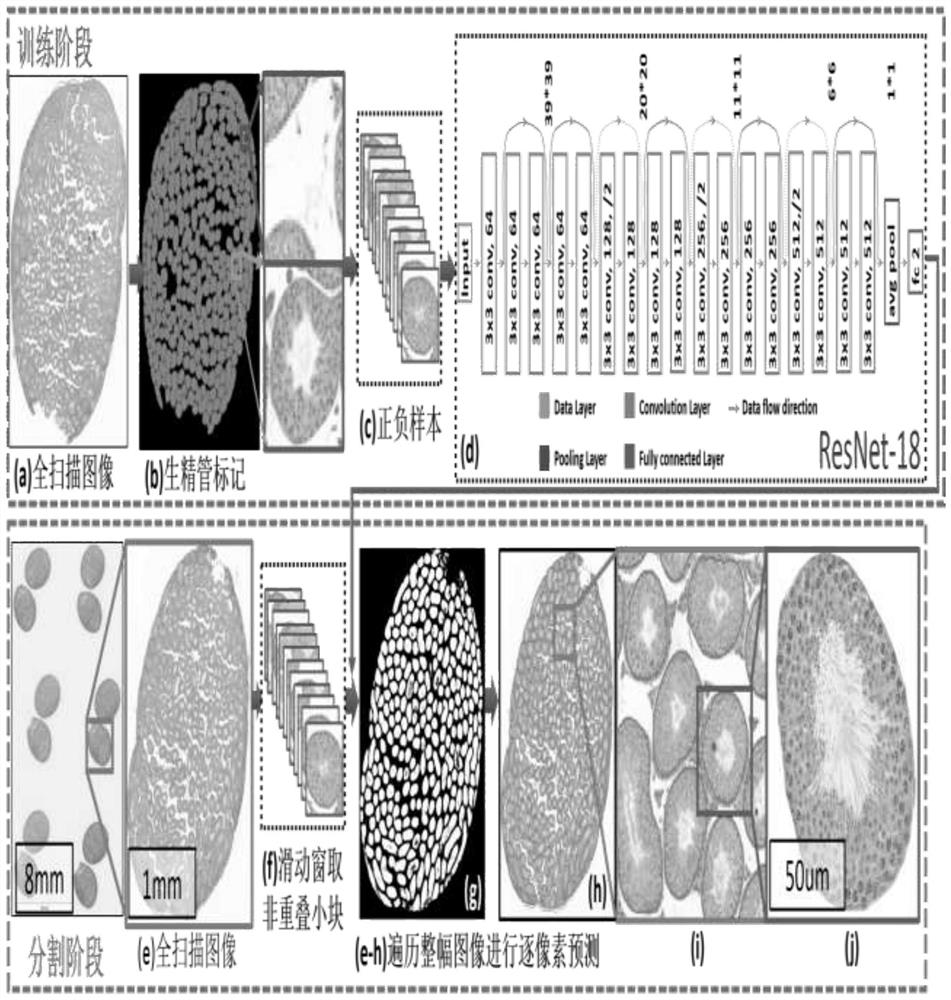 Automatic segmentation method for various tissues in mouse testis pathological section based on deep learning