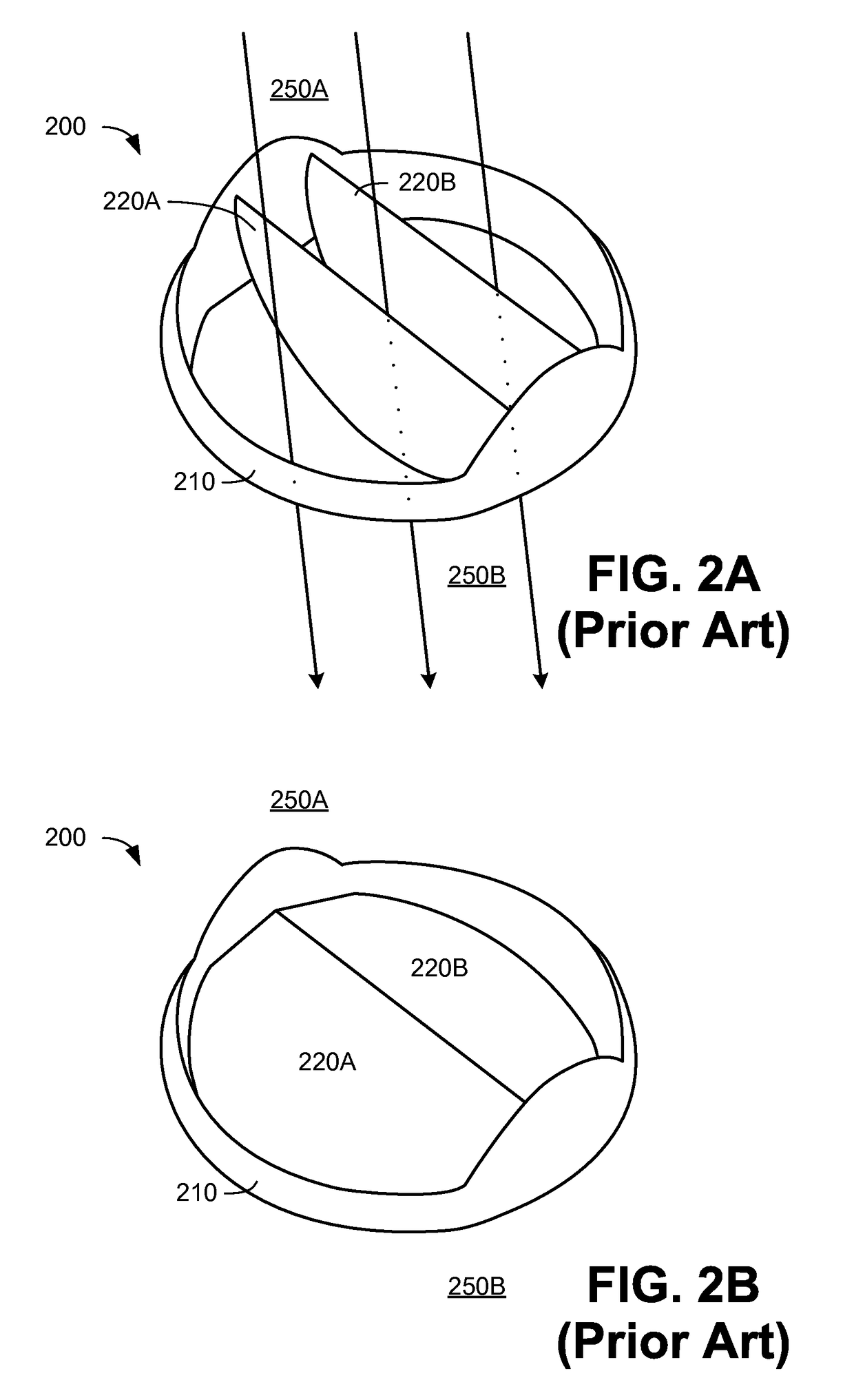 Trileaflet Mechanical Prosthetic Heart Valve