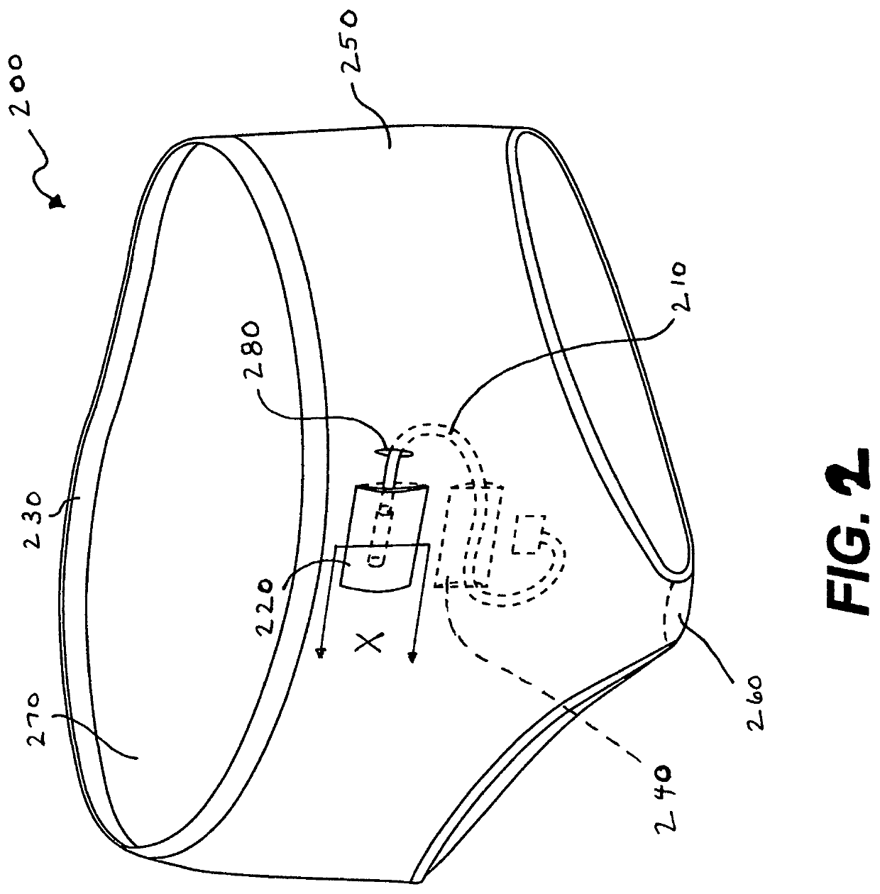 PD-Uwear: peritoneal dialysis undergarments