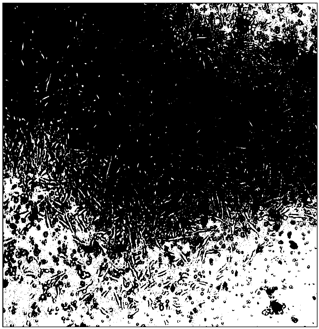 Method for quickly separating and culturing fibroblast from human skin tissues