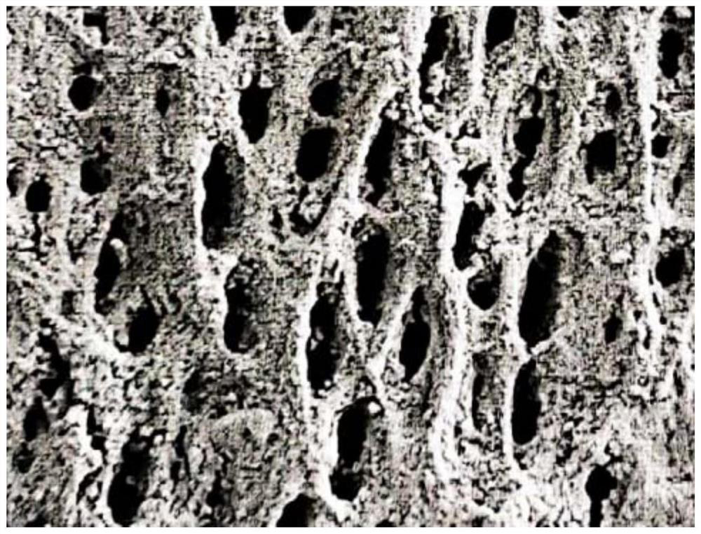 Anti-allergy toothpaste and preparation method thereof