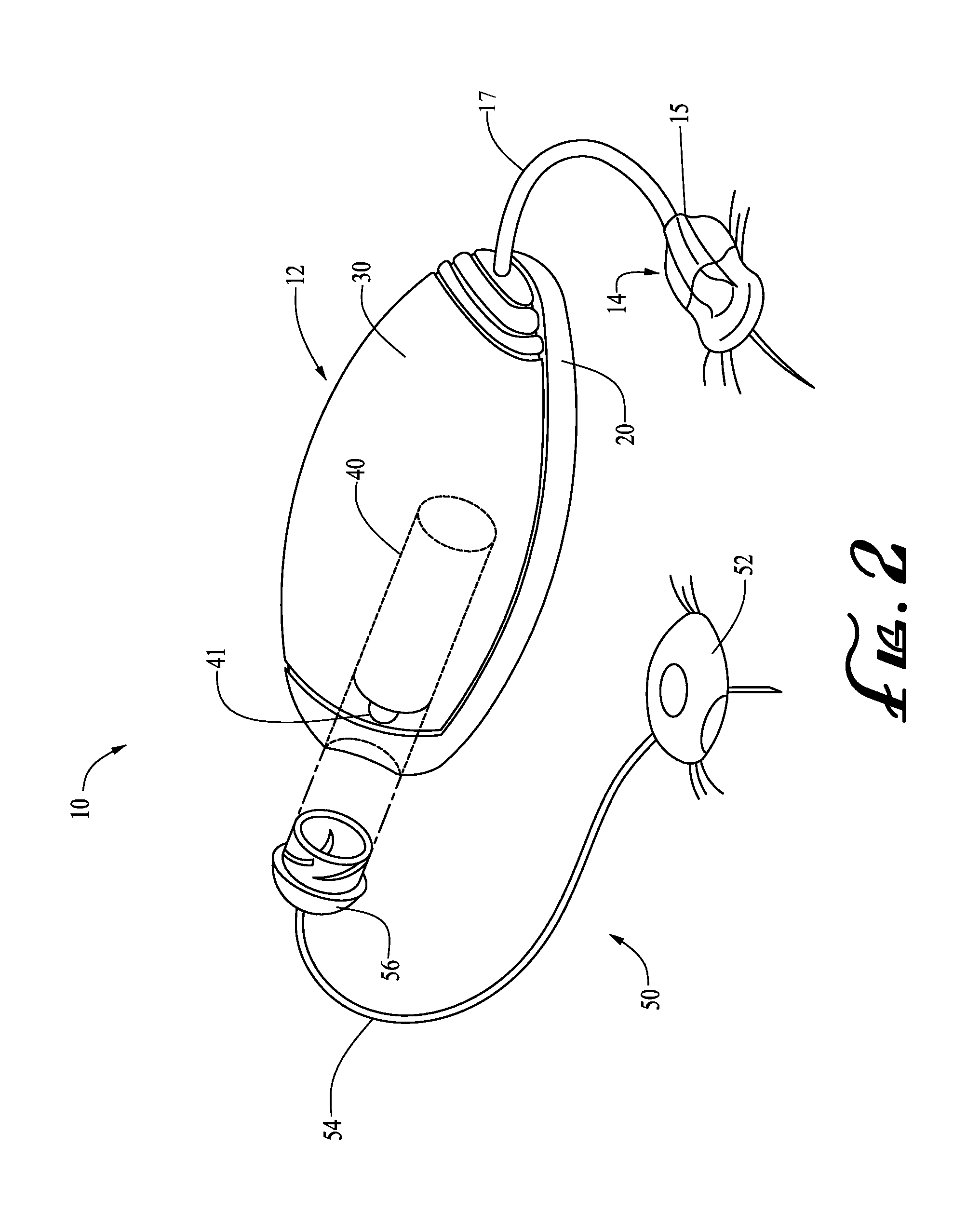 Transfer guard systems and methods