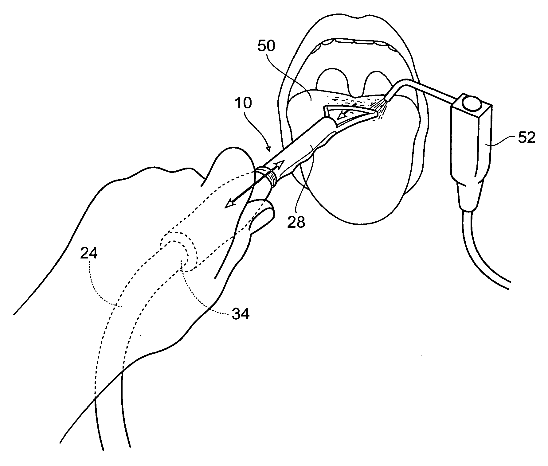 Tongue scraper and suction device