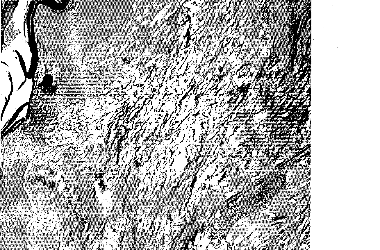 Material for promoting operation wound heal and preparation method thereof