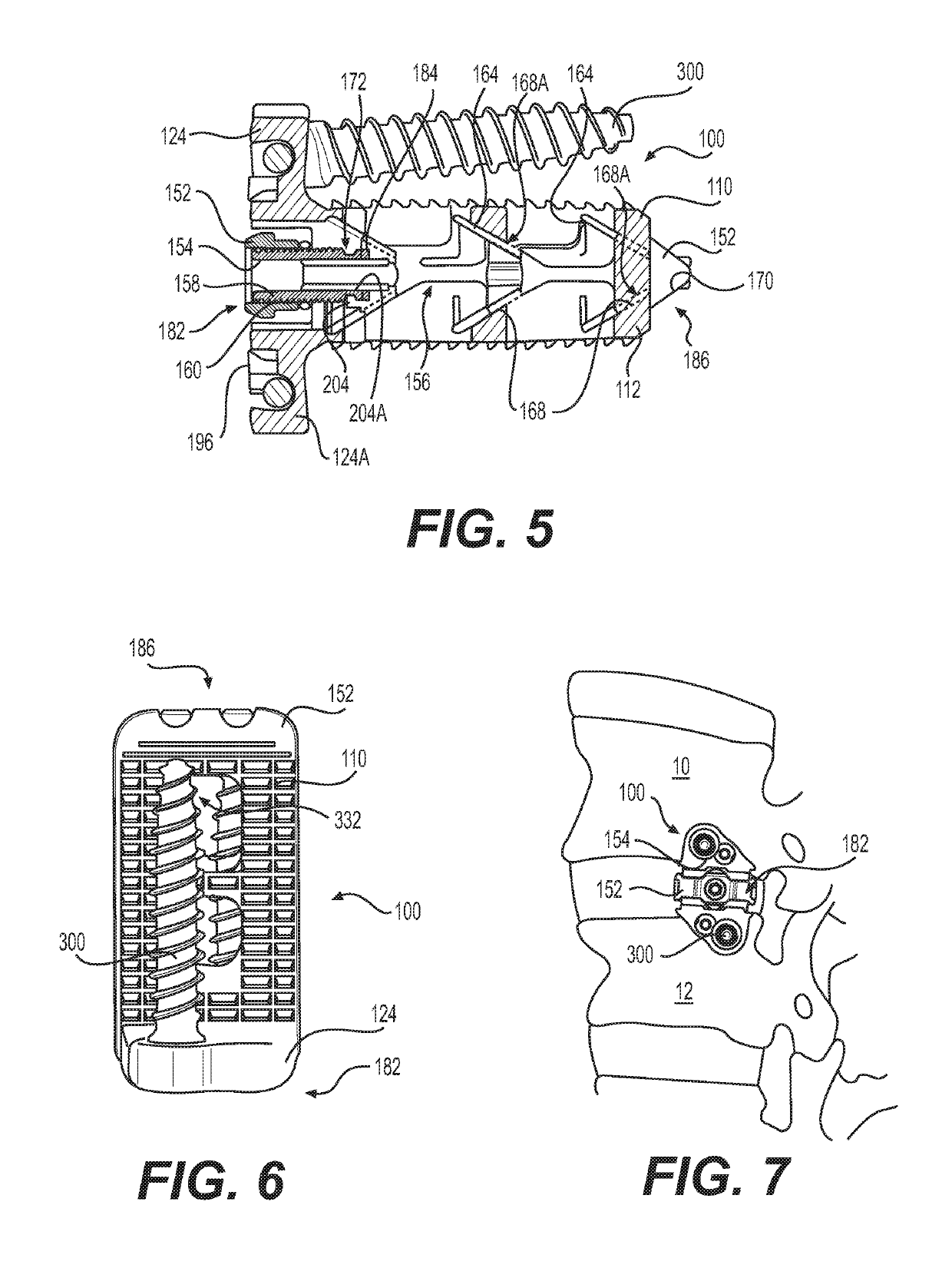 Expandable vertebral implant