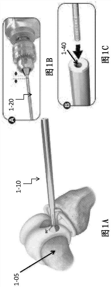 Implantation tool and protocol for optimized solid substrates promoting cell and tissue growth