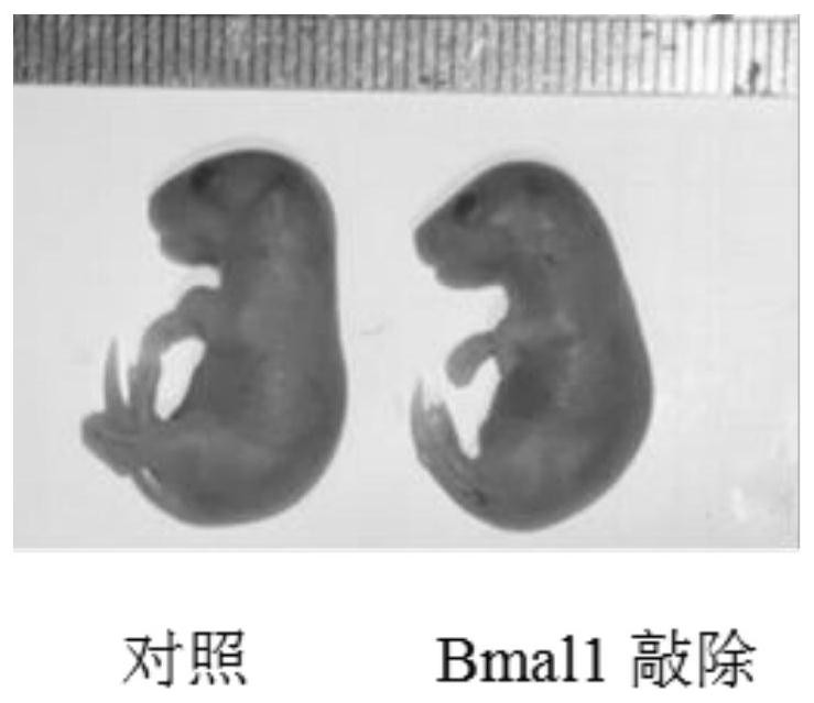 Application of Bmal1 gene in preparation of product for detecting and treating cartilage hypoplasia disease