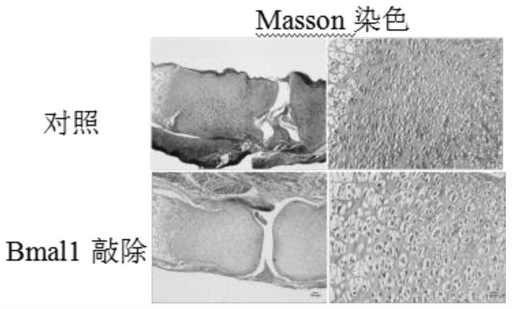 Application of Bmal1 gene in preparation of product for detecting and treating cartilage hypoplasia disease