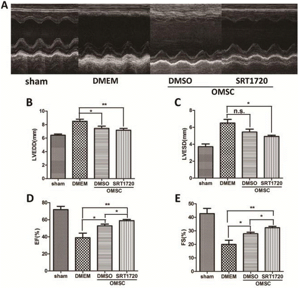 Method for improving survivability of old people mesenchymal stem cells after transplanting