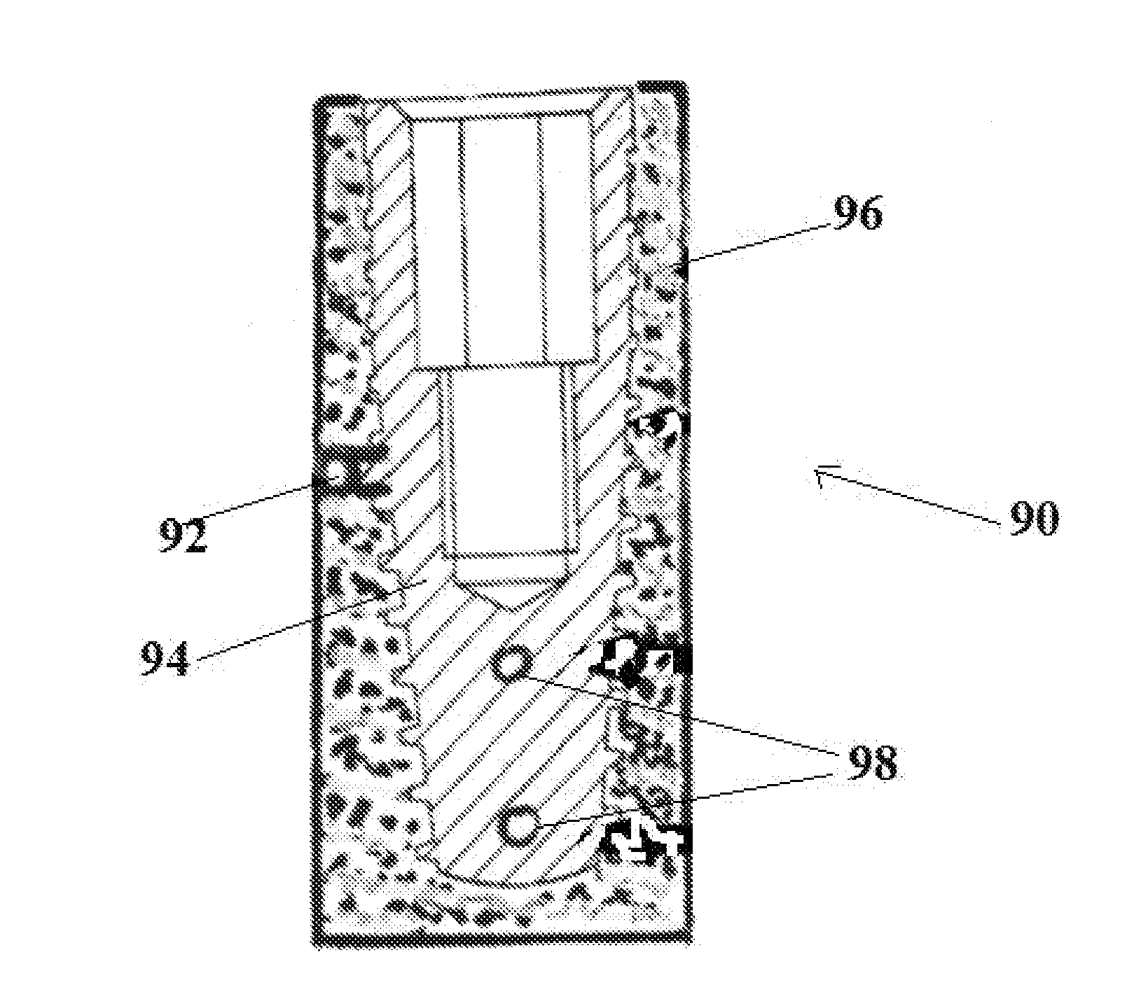 Scaffold implant system