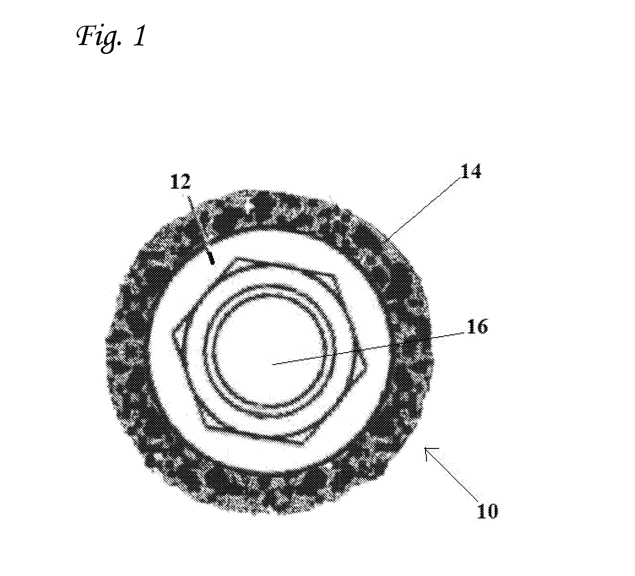 Scaffold implant system