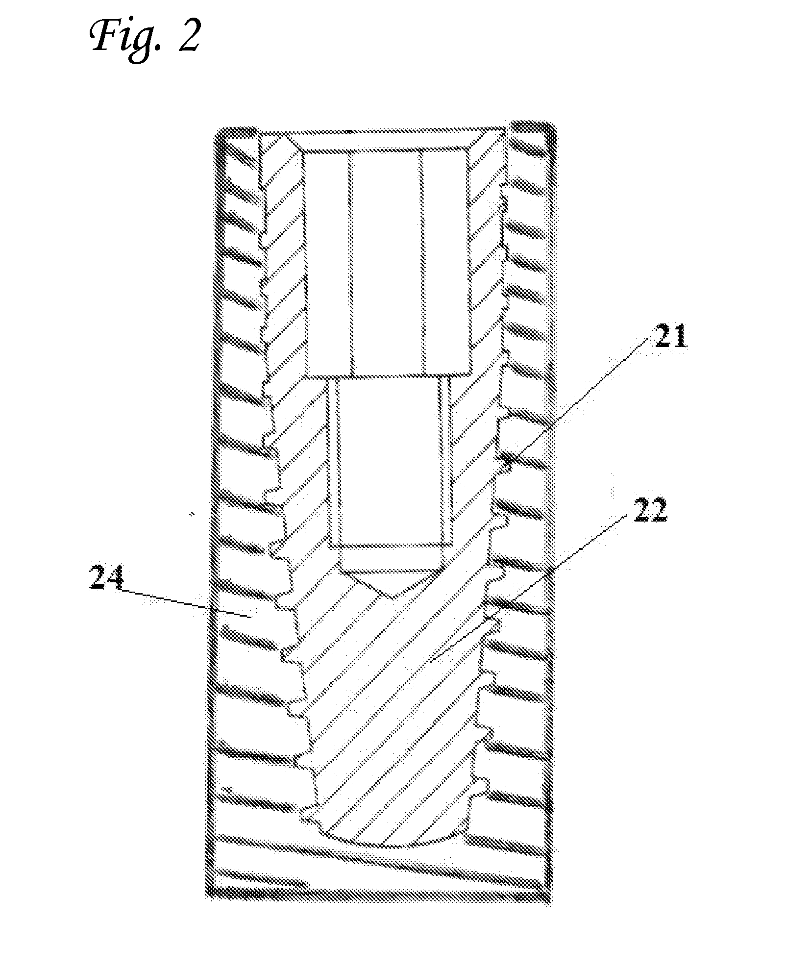 Scaffold implant system