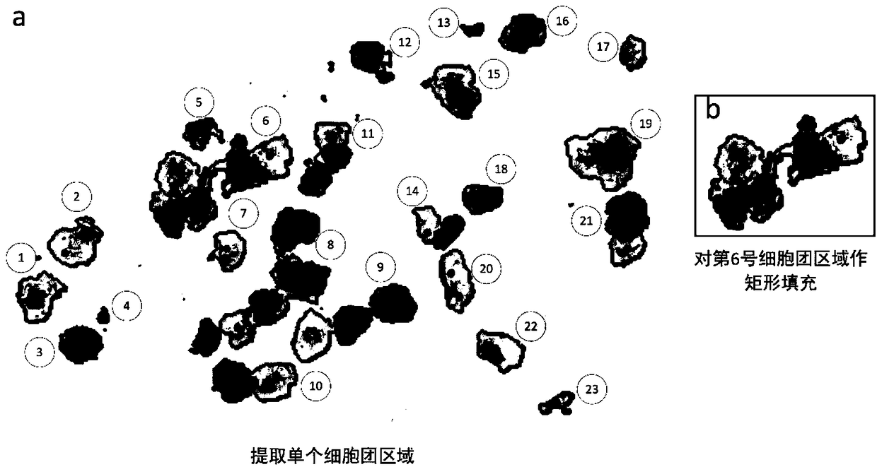 Method and system for image classification of irregular cervical cell mass