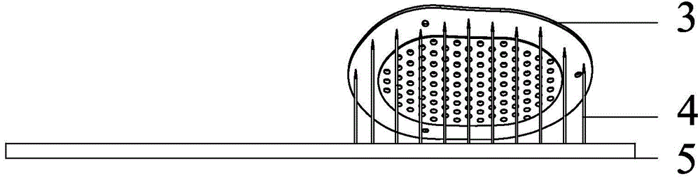 Titanium alloy skull repair prosthesis preparation method based on metal powder laser sintering 3D molding technology