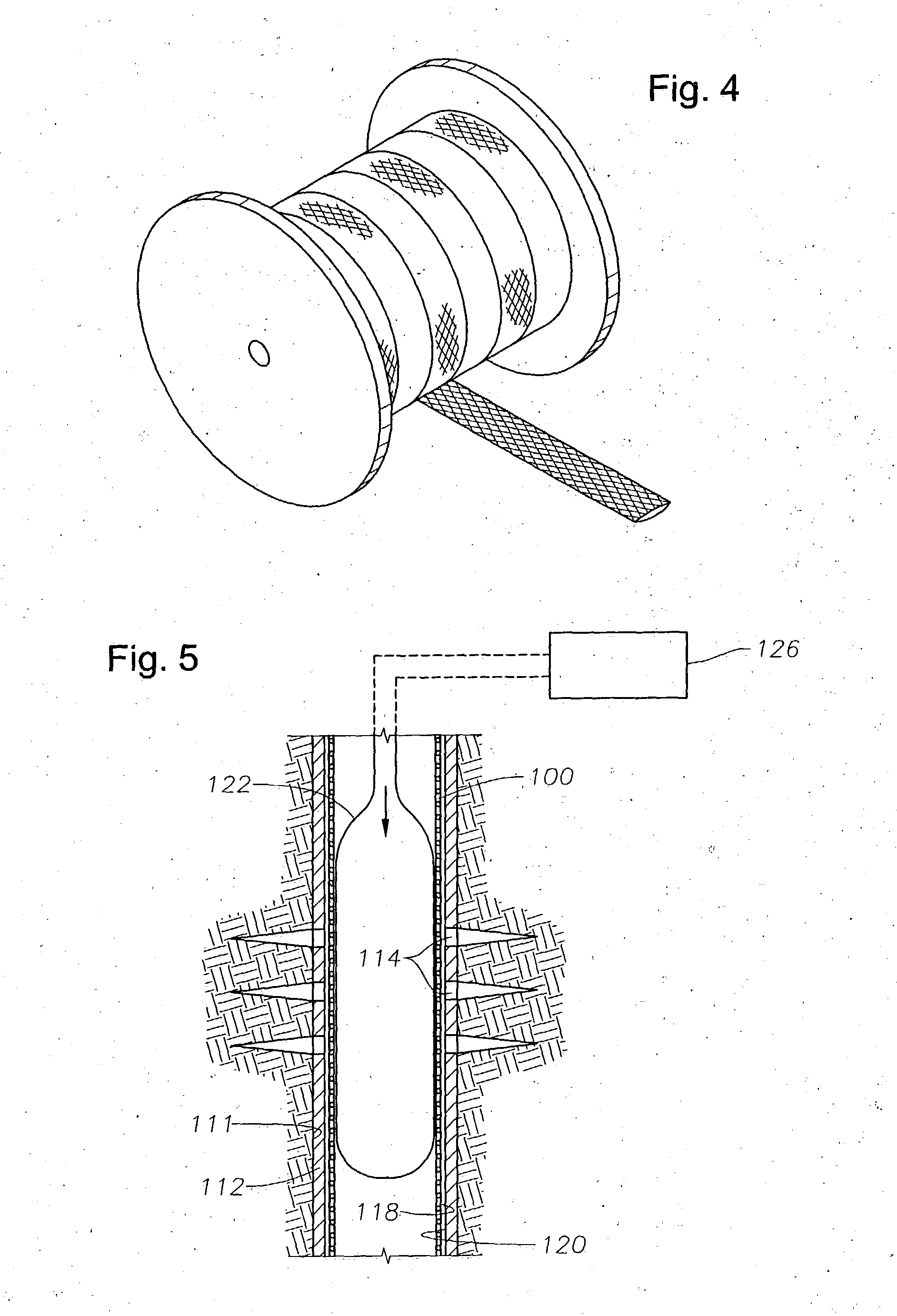 System and methods for placing a braided tubular sleeve in a well bore