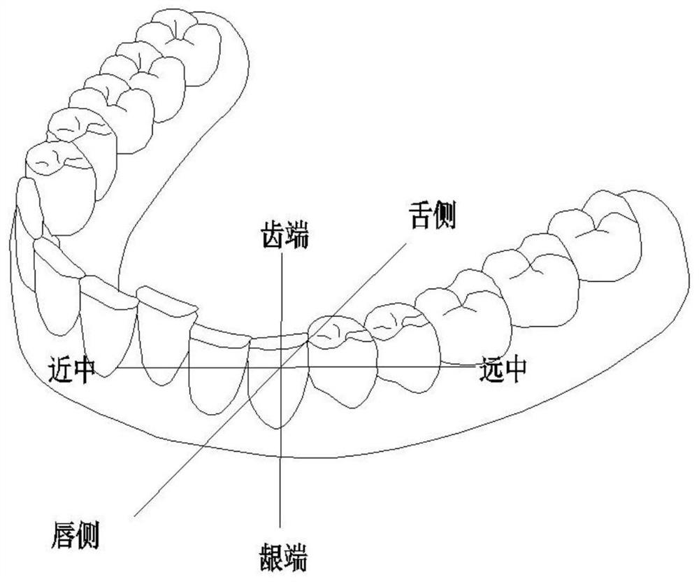 Bonding positioning device convenient to disassemble