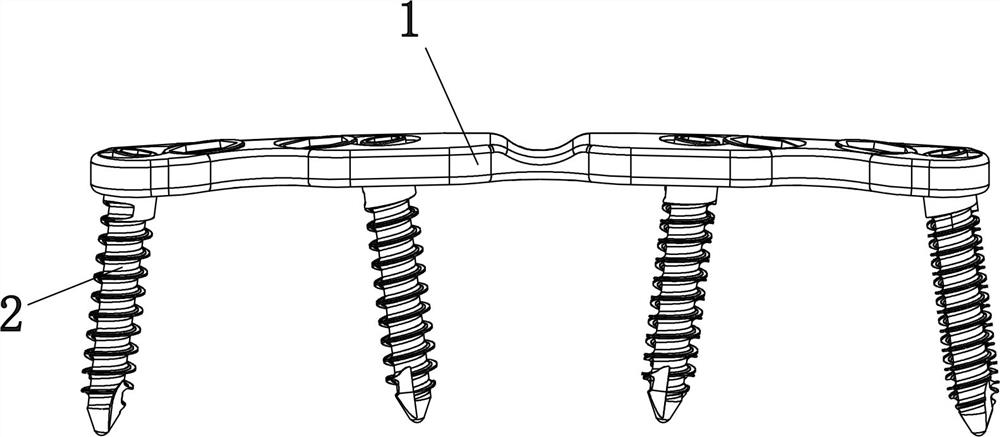 Internal fixation system for anterior cervical steel plate