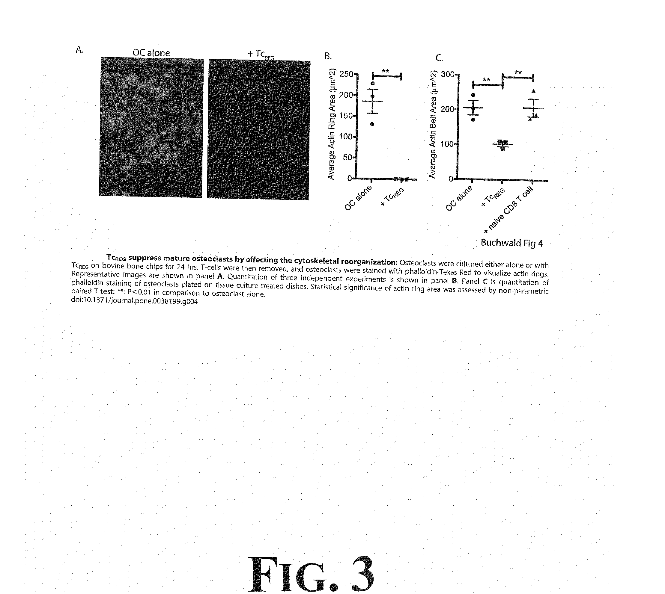 Suppression of Bone Loss by Introducing FoxP3+ CD8 T-cells (TcREG)